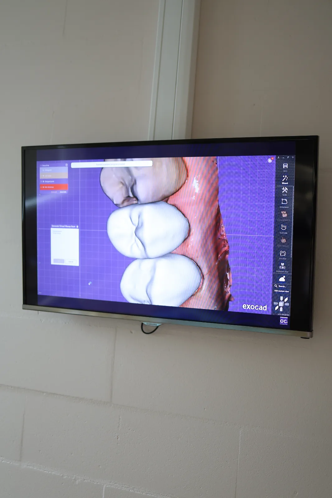 3D-tomograafia ja diagnostika